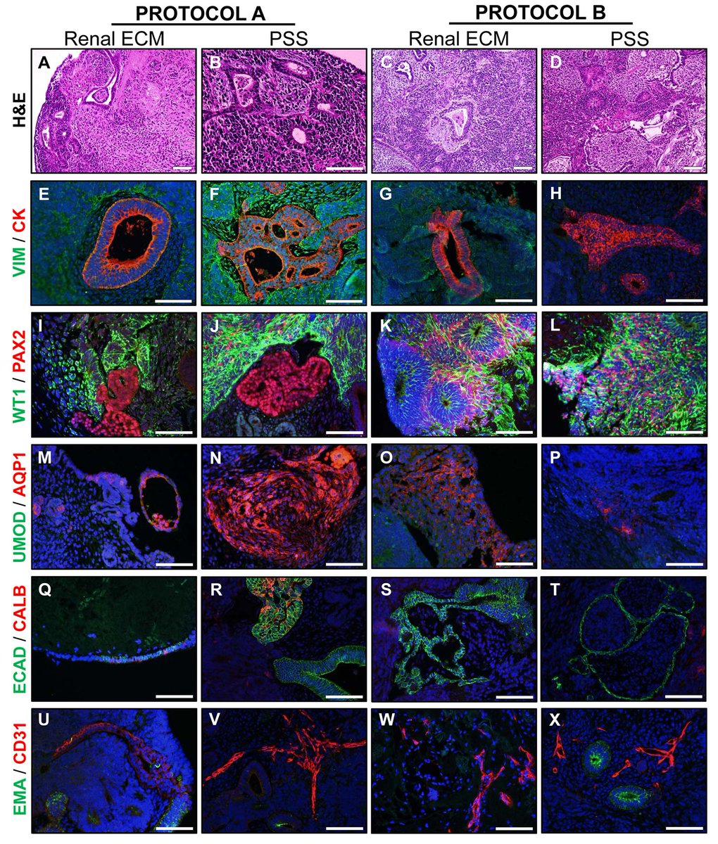 Do you know that #ALI conditions are a common feature for a succesful #celldifferentiation of #hIPSc #kidney #organoids? Oxygen tension seems to play a key role in the process. We love this topic! Learn more about it in this article from Batchelder et al: journals.plos.org/plosone/articl…