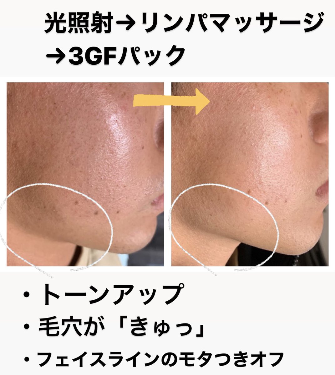 ルファルコ メンズ脱毛サロン 脱毛 大阪脱毛 脱毛サロン 光脱毛 全身脱毛 Vio脱毛 部分脱毛 ヒゲ脱毛 髭 キッズ脱毛 痛くない脱毛 フォトフェイシャル 美肌 美顔 プライベートサロン 北区 梅田 西天満 南森町 中崎町 子供脱毛 ルファルコ メンズ脱毛サロン 脱毛 大阪脱毛 脱毛サロン 光脱毛 全身脱毛 Vio脱毛 部分脱毛 ヒゲ脱毛 髭 キッズ脱毛 痛くない脱毛 フォトフェイシャル 美肌 美顔 プライベートサロン 北区 梅田 西天満 南森町 中崎町 子供脱毛