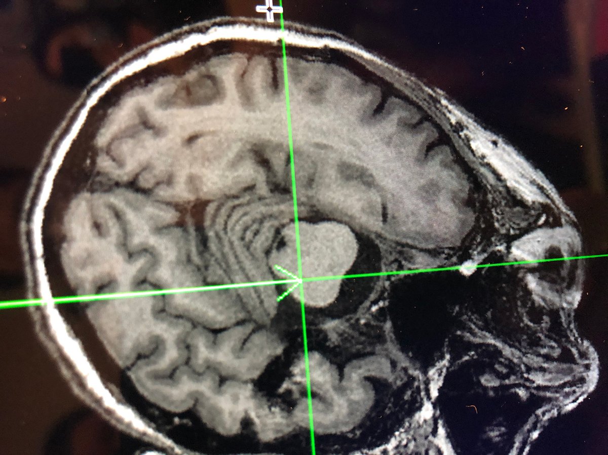 Herbert Irving Comprehensive Cancer Center tweet media