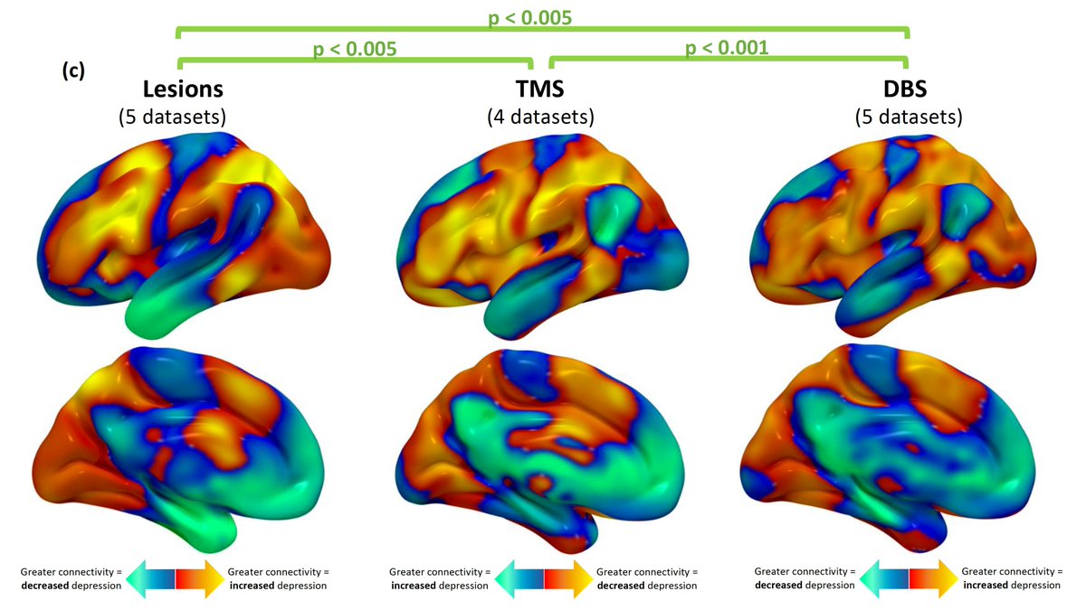 shansiddiqi's tweet image. Out now in @NatureHumBehav @SpringerNature:

TMS, DBS, and lesions converge on common causal circuits in neuropsychiatric disease. 
Lesions reveal better TMS/DBS targets. All 3 modalities can modulate similar circuits.

Thanks @foxmdphd and 24 co-authors!
rdcu.be/cnZQ1