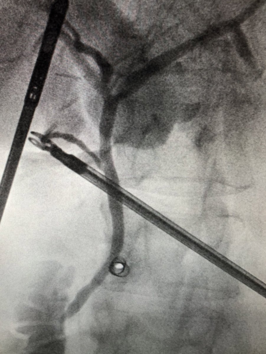 Elizabeth Hechenbleikner, MD tweet media