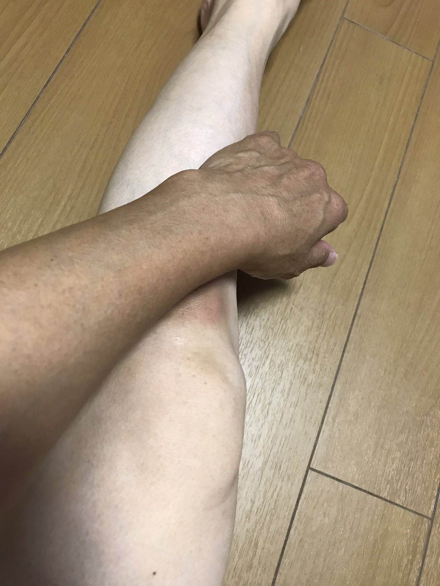 ট ইট র よしっ よしこ 私の生足に男の手が じゃなくてこれ 私の手と足 太い細いとか打撲とかエロいとかじゃなくあかんやろその日焼け T Co Dv3eba6g ট ইট র