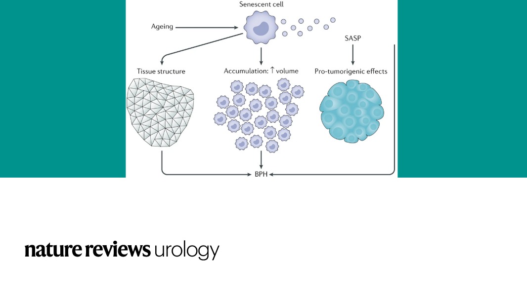 NatRevUrol's tweet photo. #NEWinNRU In this Review the role of cellular senescence in the pathogenesis of prostatic disease is discussed #ProstateCancer #UroBPH @GaelleFiard @VStavrinides @Emma_S_Chambers @susan_heavey @AkbarLab @EmbertonMark https://t.co/DLIHPKpaSP https://t.co/7Co7xXDMGw