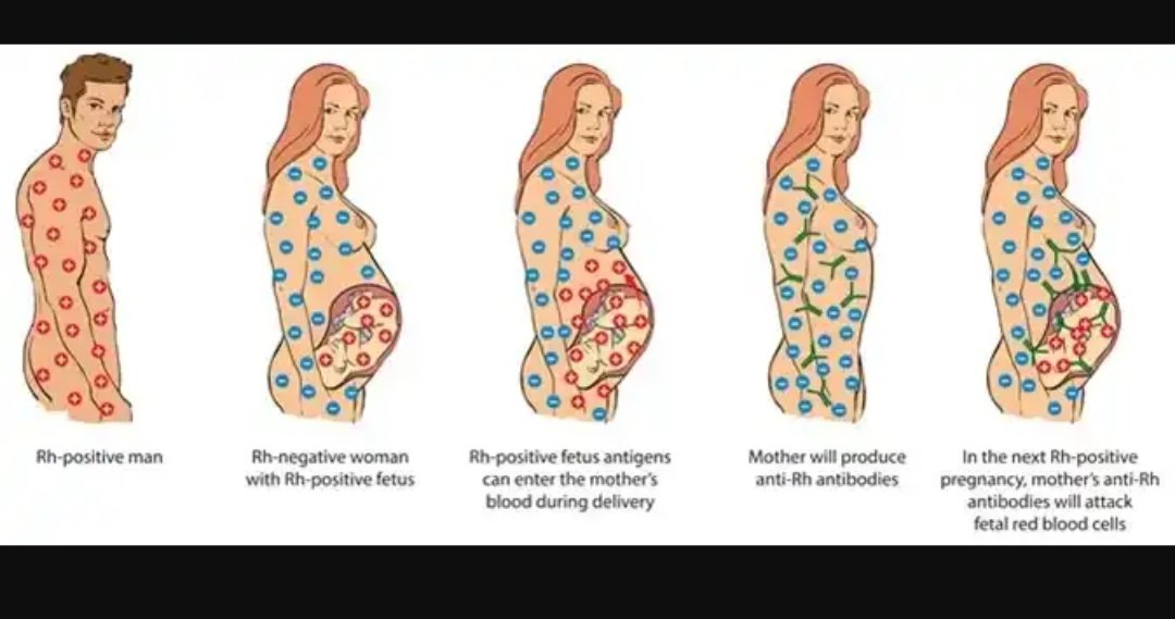 what is rh factor what is rh factor