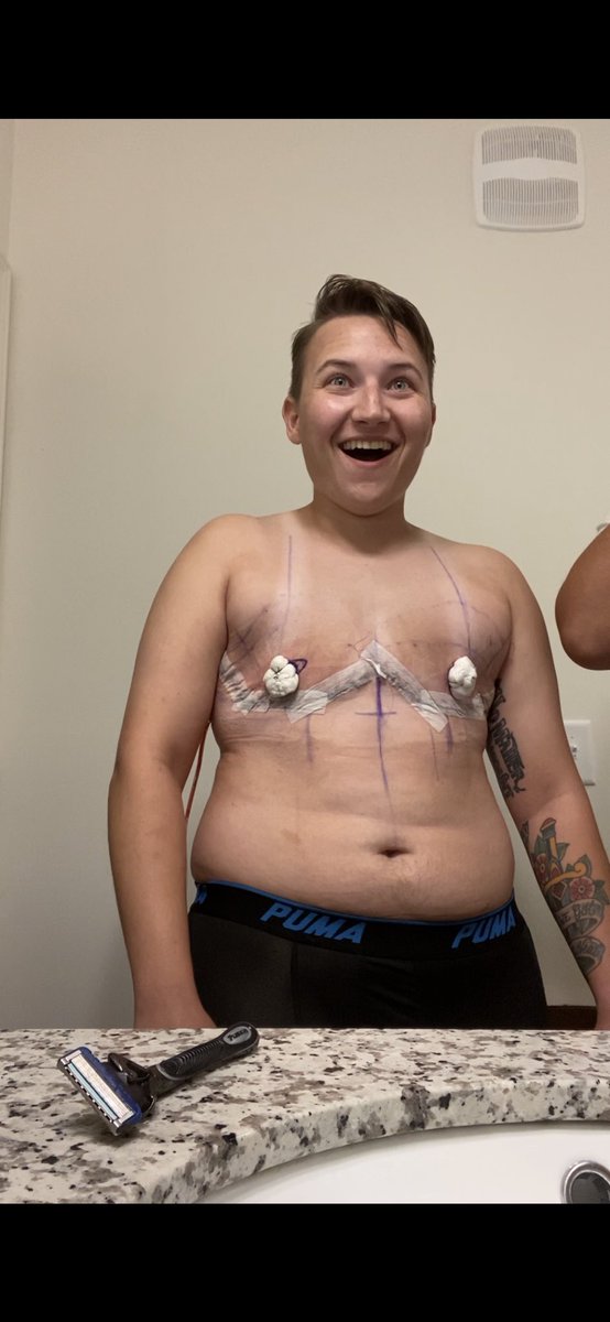 ultra_codex's tweet photo. here is the shock then pure joy as I got to see my chest for the first time.  I have waited nearly a decade for this moment. couldn’t be happier. 💙 #TopSurgery https://t.co/y7c4kDtyNj