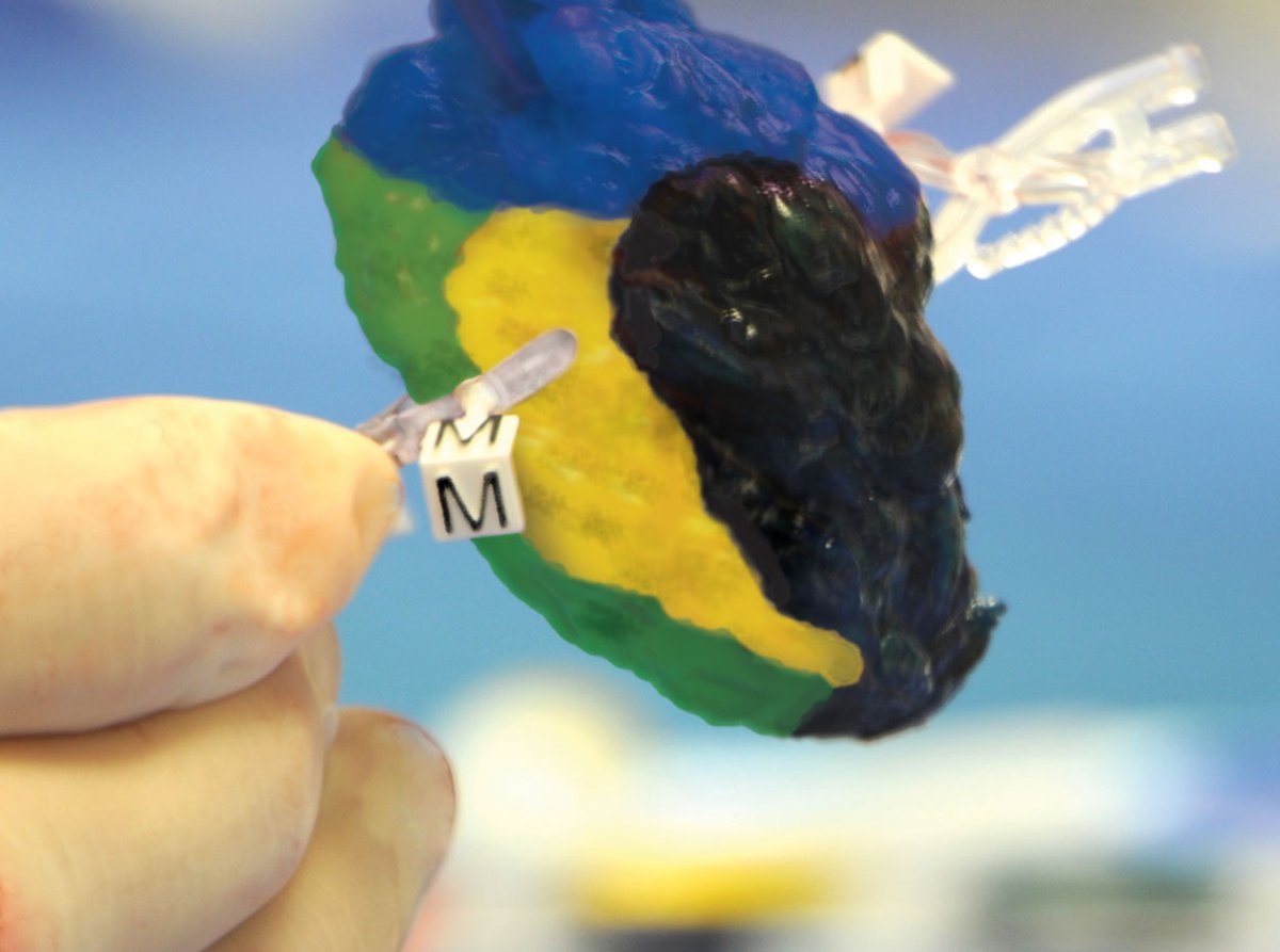 VectorSurgical's tweet image. #CorrectClips are radiographic markers that feature a letter indicating orientation. Visit VectorSurgical.com to request a sample.