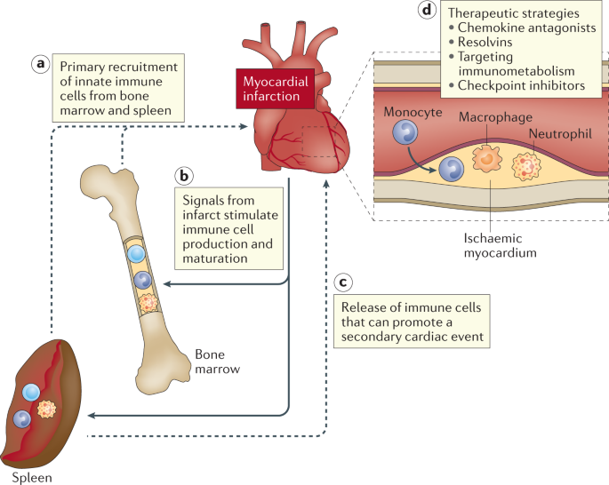 NatRevImmunol's tweet photo. Immune-based therapies in cardiovascular and metabolic diseases: past, present and future https://t.co/CiXjUjWlJe https://t.co/uobshyeI3z