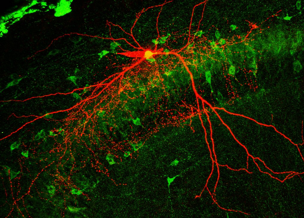 Josef Kittler (@josefkittler) on Twitter photo Very excited to see this study out in @Elife on the role of Miro1 dependent mitochondrial dynamics in parvalbumin interneurons. Great work from <a href="/GeorginaKontou/">Georgina Kontou</a> with brilliant help from colleagues in the Kittler, Mann and Salinas labs: elifesciences.org/articles/65215 Very excited to see this study out in @Elife on the role of Miro1 dependent mitochondrial dynamics in parvalbumin interneurons. Great work from <a href="/GeorginaKontou/">Georgina Kontou</a> with brilliant help from colleagues in the Kittler, Mann and Salinas labs: elifesciences.org/articles/65215