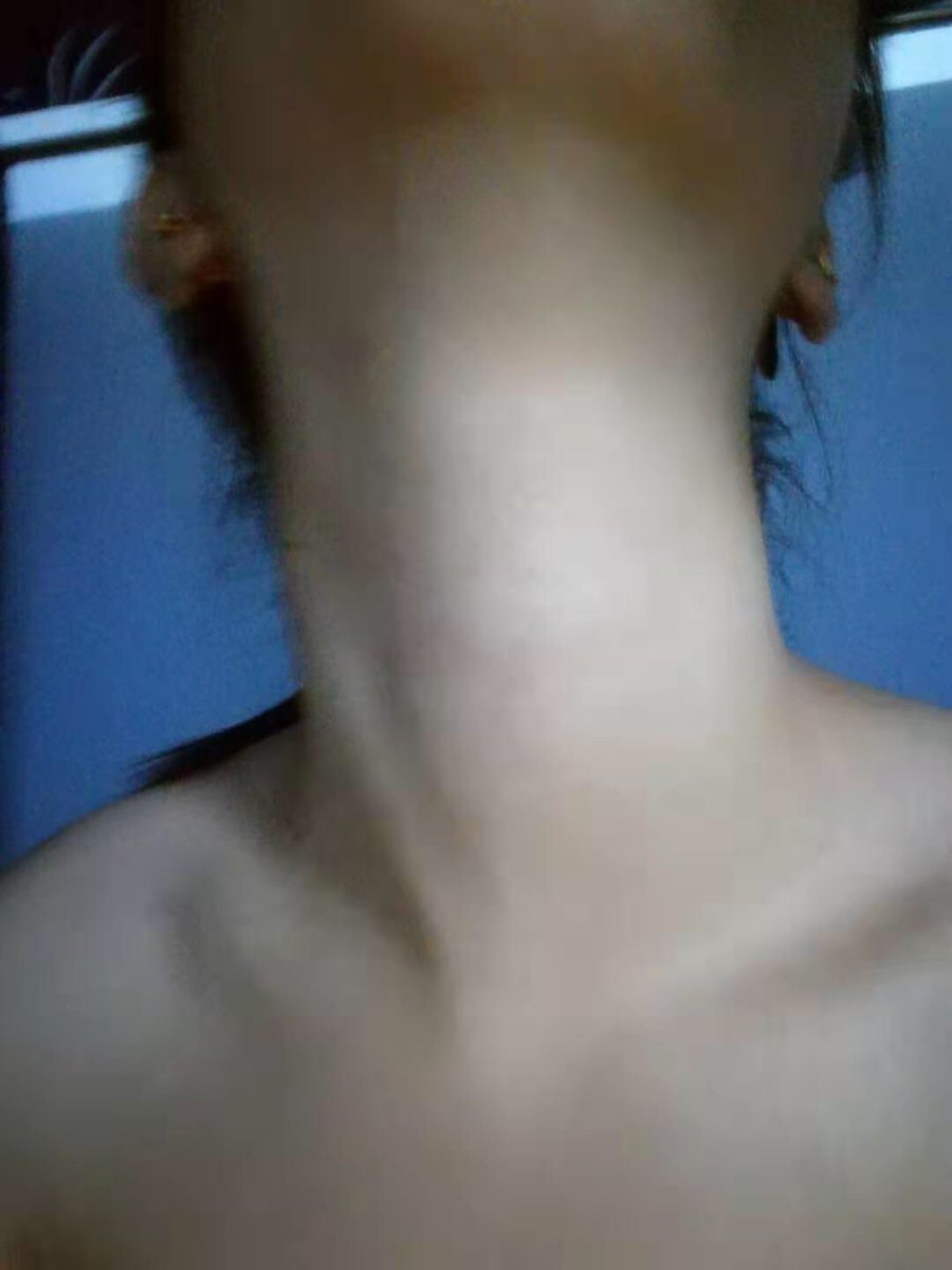 Nk_Fzty's tweet photo. beautiful neck https://t.co/HQNzfkzTUt