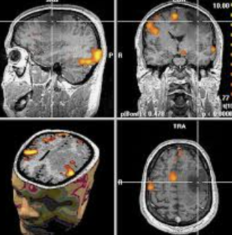 ecalixto's tweet photo. El cerebro NO se enamora de cualquier persona, nos enamoramos de aquellos personajes que cubren las aspiraciones y proyecciones necesarias para liberar dopamina, adrenalina, oxitocina y endorfina.

#NeuroTuit https://t.co/ShBAQDlTog