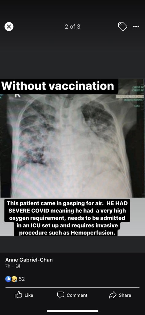 stephgabriel17's tweet image. Sharing from my sister’s (who is an infectious disease specialist) updates — No vaccine is superior to the other. It works and it saves lives!! Let’s gooooo.

May hope guys. Take it.