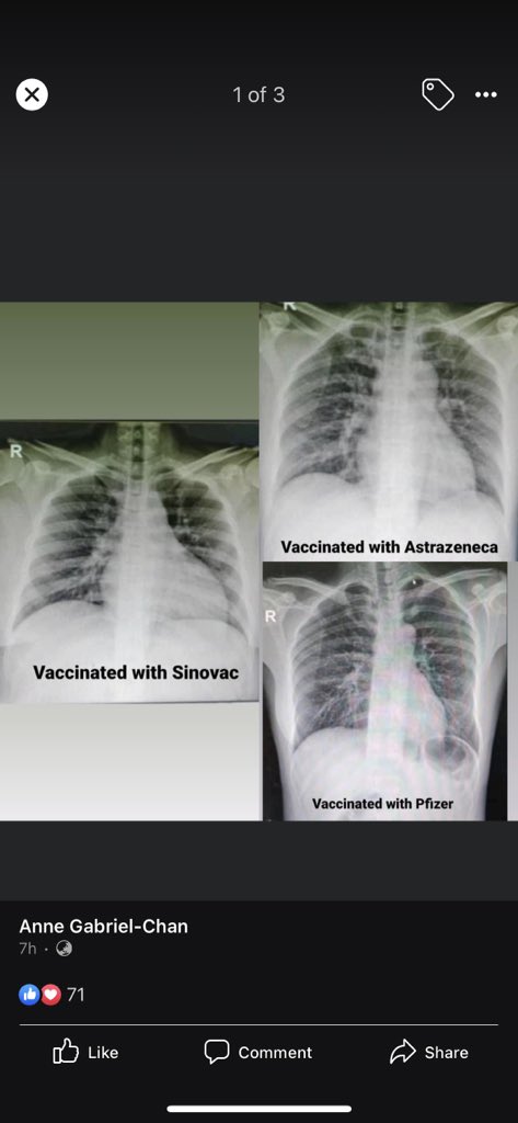 stephgabriel17's tweet image. Sharing from my sister’s (who is an infectious disease specialist) updates — No vaccine is superior to the other. It works and it saves lives!! Let’s gooooo.

May hope guys. Take it.