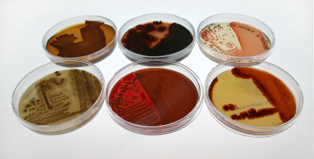Leibniz-Institut DSMZ (@leibniz_dsmz_en) on Twitter photo 📣LAST REMINDER: Submit your abstract for oral and poster presentations at the "International workshop on Biology of Bacteria Producing Natural Products"
🗓 DL for submission: 31 July
👉 prelim programm & more: bit.ly/3qOopus
<a href="/VAAM_Microbes/">VAAM - Vereinigung f. Allg. u. Ang. Mikrobiologie</a>
#workshop #antimicrobials 📣LAST REMINDER: Submit your abstract for oral and poster presentations at the "International workshop on Biology of Bacteria Producing Natural Products"
🗓 DL for submission: 31 July
👉 prelim programm & more: bit.ly/3qOopus
<a href="/VAAM_Microbes/">VAAM - Vereinigung f. Allg. u. Ang. Mikrobiologie</a>
#workshop #antimicrobials