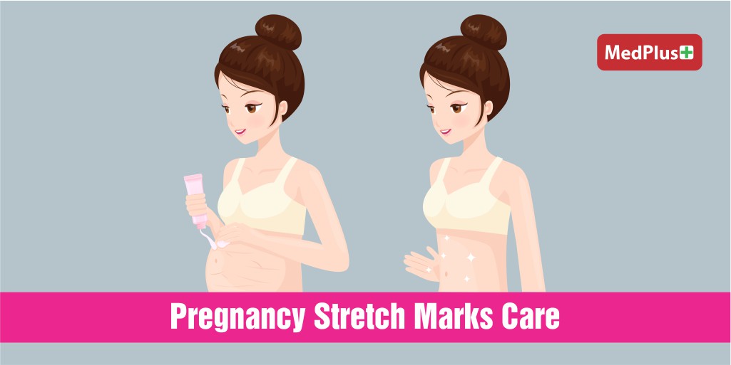 MedPlusIndia's tweet photo. How to Remove Stretch Marks After Pregnancy
https://t.co/TIlqBGiZlP
#stretchmark #stretchmarks #removestretchmarks #fightingstretchmarks #postpregnancy #pregnancystretchmarks #bodycare #skincare #pregnancytummy #pregnancyskin #cellulite #removecellulite #treatstretchmarks https://t.co/DoamR13N3I
