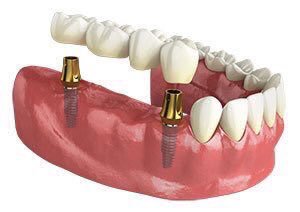Teeth_Planting tweet picture