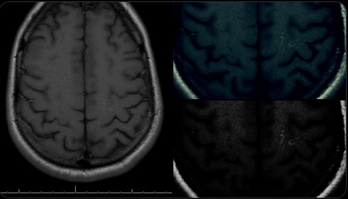 EddieWhoWrites's tweet image. Well, whatever #DreamHacking equipment that my neighbor is running above me, I am now wide awake from a weird ass dream.

Gee, I wonder where the scar on my #brain came from...