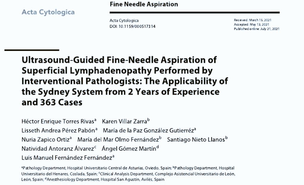 Héctor-Enrique Torres-Rivas, MD (@duckhuca) on Twitter photo Finally our paper is available...
Ultrasound guided fine needle aspiration of superficial lymphadenopathy performed by interventional pathologists.
#ActaCytologica <a href="/KargerPublisher/">Karger Publishers</a> <a href="/USFNA_SPAIN/">Interventional Ultrasound for Pathologists</a>
<a href="/BibliotecaHUCA/">Biblioteca HUCA</a> <a href="/KarenLVZ/">Karen VZ</a> <a href="/Maripaz_Gtz/">Maripaz</a> #HUCA_Asturias
pubmed.ncbi.nlm.nih.gov/34289486/ Finally our paper is available...
Ultrasound guided fine needle aspiration of superficial lymphadenopathy performed by interventional pathologists.
#ActaCytologica <a href="/KargerPublisher/">Karger Publishers</a> <a href="/USFNA_SPAIN/">Interventional Ultrasound for Pathologists</a>
<a href="/BibliotecaHUCA/">Biblioteca HUCA</a> <a href="/KarenLVZ/">Karen VZ</a> <a href="/Maripaz_Gtz/">Maripaz</a> #HUCA_Asturias
pubmed.ncbi.nlm.nih.gov/34289486/