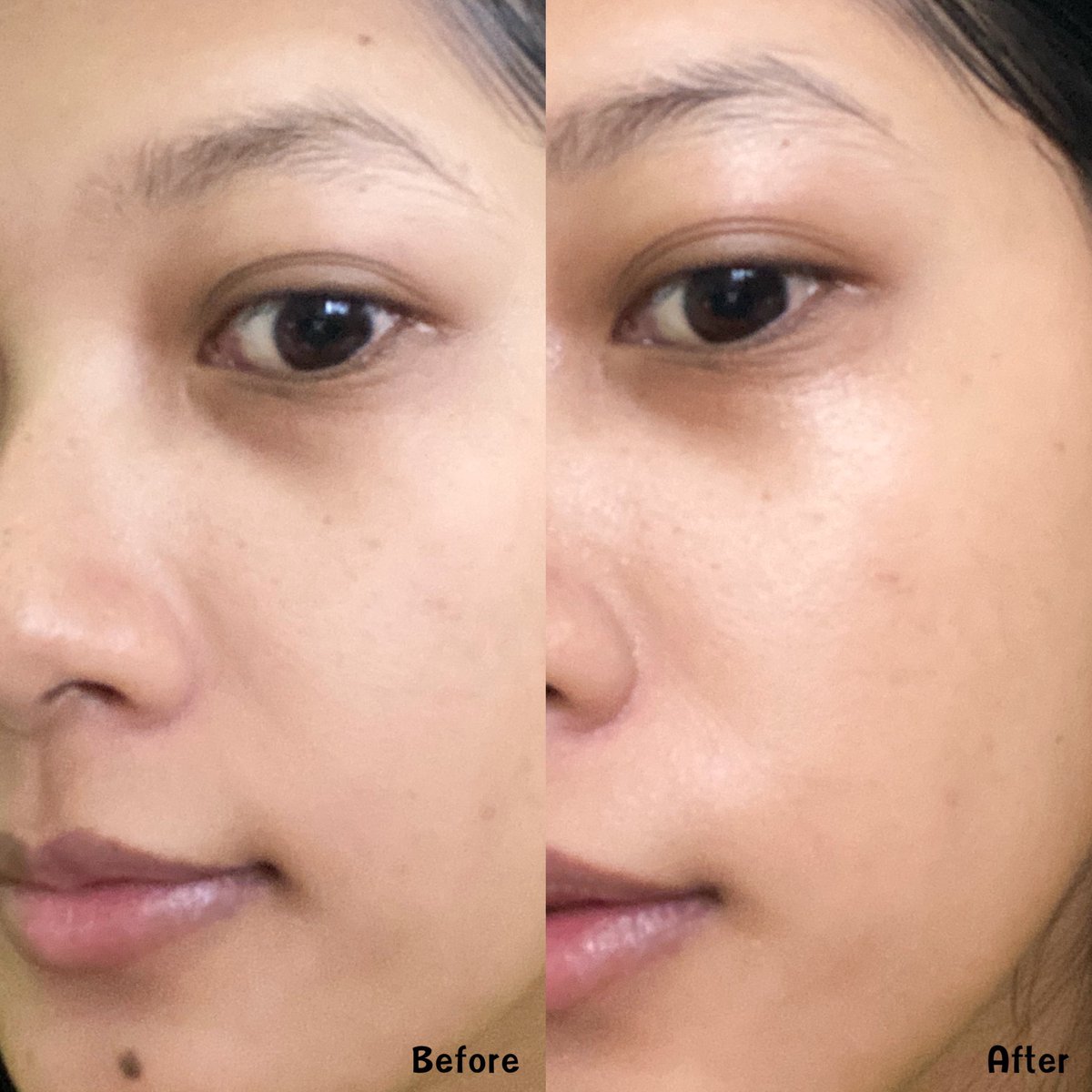 evevereview's tweet image. ทุกคนบูสเตอร์เซรั่มตัวนี้คือน่าลองมากคือเค้าจะช่วยเพิ่มความชุ่มชื้นให้ผิวดูสุขภาพดี ตัวนี้เค้าใช้ไฮยาโมเลกุลเล็กที่จะช่วยกักเก็บน้ำใต้ผิวได้มากถึง 1,000 เท่าเลยนอกจากนั้นยังปรับผิวให้ดูกระจ่างใสขึ้นด้วย ส่วนผสมหลักๆนี่ import มาจากยุโรปเลยนะ ราคาโปร 790.- #pentaskinreview