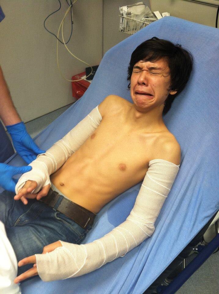 new song “simplemindedteens” out meoww! ep next friday, song is about when i broke both my arms in 10th grade, if u listen u can roast me, fuckouttahereee youngculture.lnk.to/simple