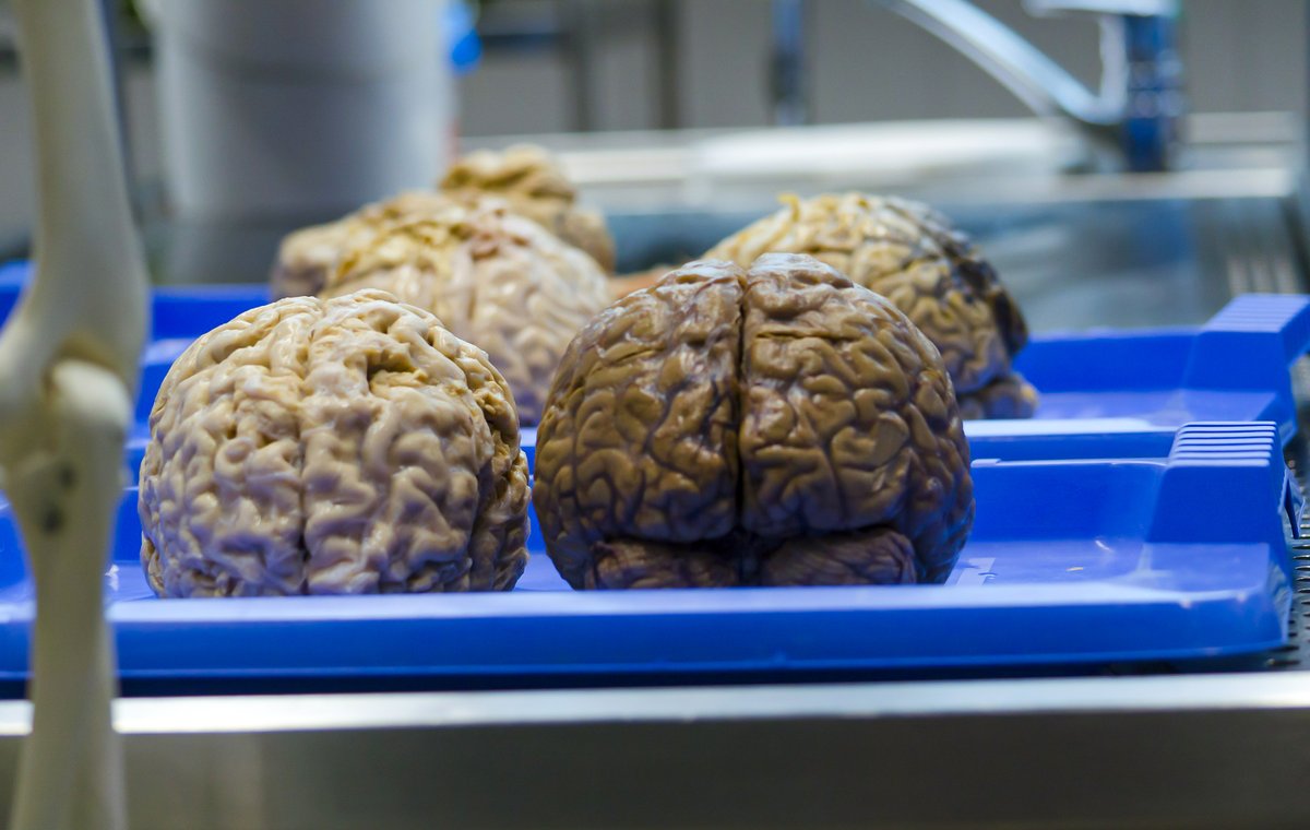 🧠¿Sabías que el cerebro es el resultado de 2,5 millones de años de evolución humana? Es de los órganos más importantes, pues se encarga de controlar las actividades cognitivas y las reacciones del organismo. Por ello, hoy nos unimos a la celebración del #DíaMundialDelCerebro