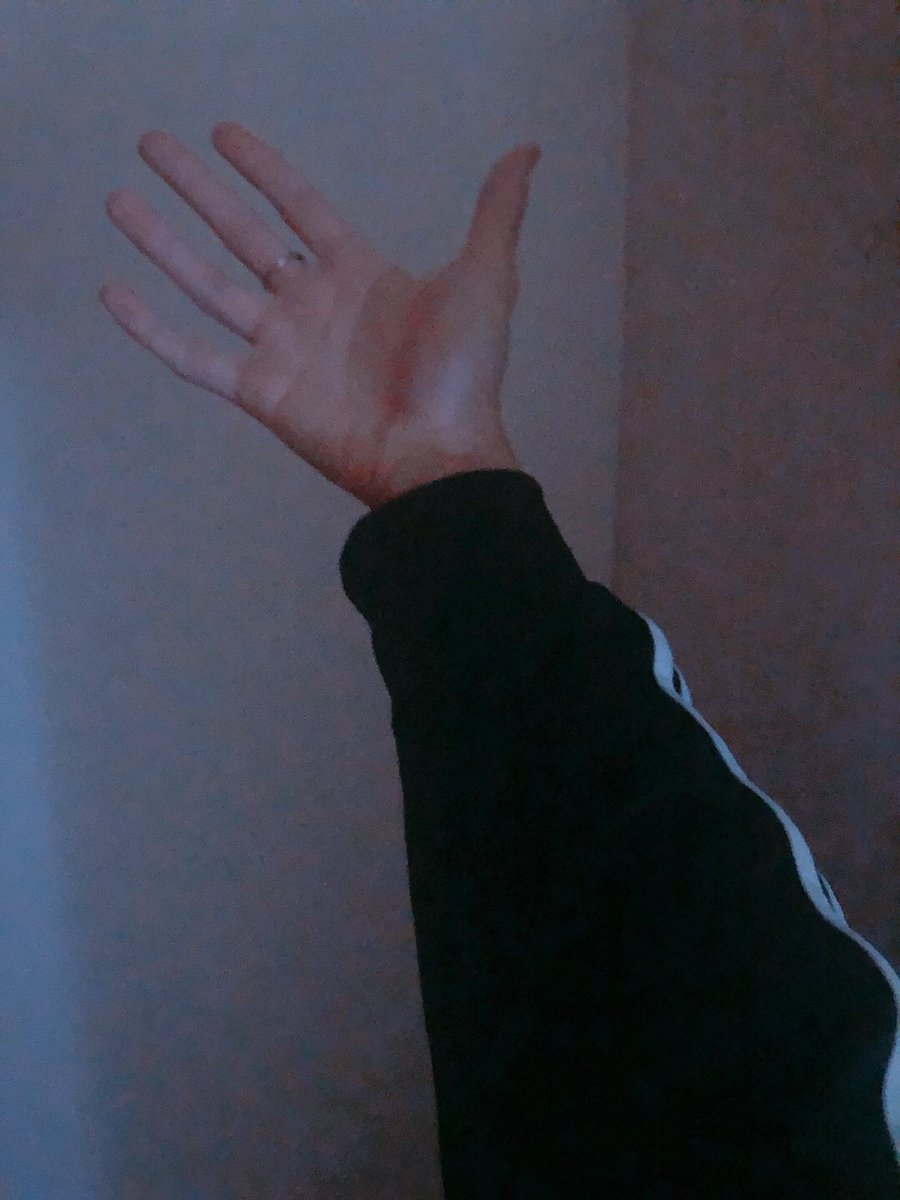 โอยยยยจีซองงงง คือฟค.มาหวีดจีซองกับอดิดาสแล้วจีซองแกมางี้เลย แกมาแบบยี้เลย โอ้ยยยกุตายดีกว่า