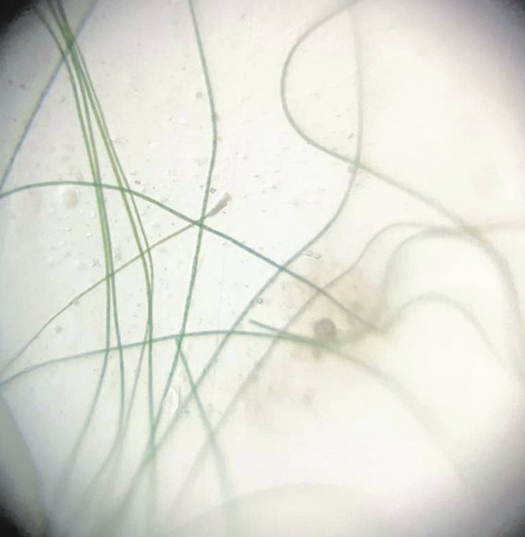 helmlinger_m's tweet photo. How creative can #sciencecommunication get? Endlessly! Big shout out to @communitylabor & @oekoprog for their #spirulina #scivival game: Simulating food crisis, with #algea as home-grown protein alternative. On day 20 of spoiling my babies I took a first pic with #foldoscope 🧪🔬 https://t.co/89EESOwso4