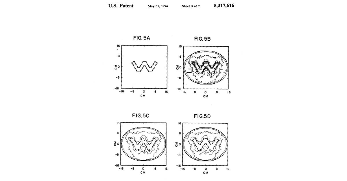 WARF_News's tweet image. As shown in this #PatentArt from 1994, a group of @UWMadison inventors created a new method to better control the intensity of rays within a radiation therapy beam. These figures depict dose distributions in a hypothetical 'W' shape. #ThrowbackTechnology
