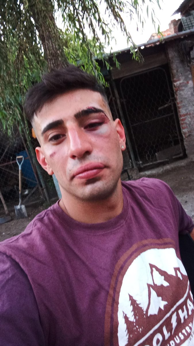 Ami los golpes se me van pero los besos a tu novia quien se los borra 🤣