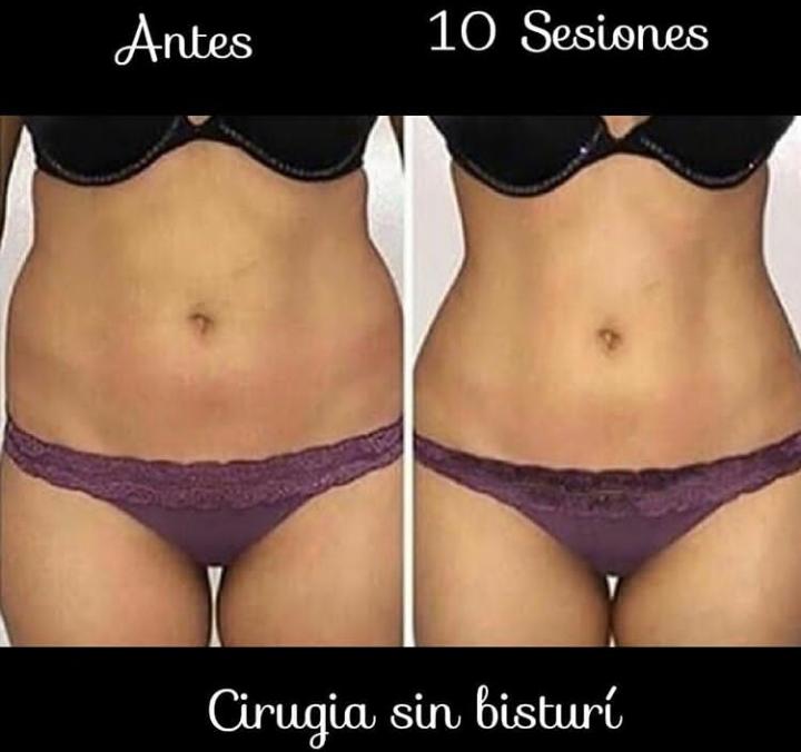 Ori__Jimenez's tweet photo. Fisiospa saludintegral# prevencion# de salud fisica integral. Tratamientos #moldea.contactame al WhatsApp 0414- 0110688. https://t.co/nZ6THL1Ux9