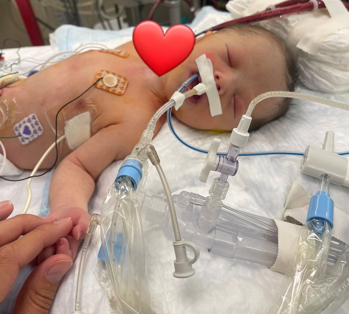 WE BEG &amp; PLEAD WITH THE WHOLE WORLD TO PLEASE PRAY FOR OUR SON, MACKLIN KARIUS!

We want God to hear Macklin's name every second! He's fighting for his life and needs as much support as he can get!

PLEASE, PLEASE, HELP US GET THE WORLD TO #PrayForMacklin

gofund.me/89c0ee0c