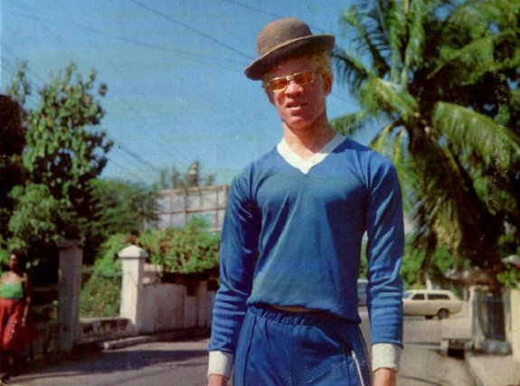 Yellowman. Винстон Фостер Yellowman. Yellowman Reggae. Yellowman с женой.