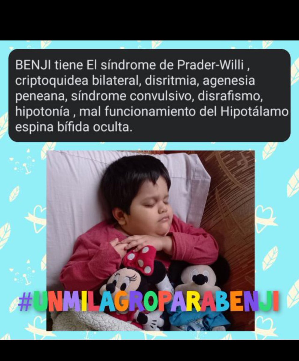 MilagroparaUn's tweet photo. @RicardoMoran @MilagroparaUn ayúdanos, mi hijito tiene el síndrome de prader willi ,Agenesia peneana, Criptoquidea bilateral, Disrafismo anal, espina bífida oculta, retardo psicomotor, hipotonia muscular, disritmia, síndrome convulsivo, hipotonia muscular. https://t.co/I4BfaWrSfo