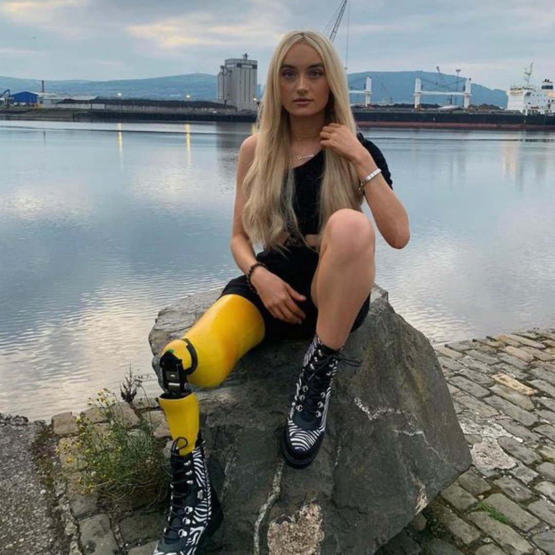 Huge congrats to Bernadette for being the first person with a disability to be a finalist in the Miss Northern Ireland competition!