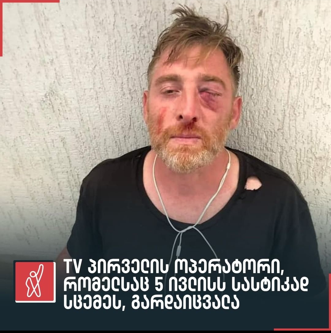 slverjjk's tweet image. Tw // death
In july 5th, in Georgia during the pride movement an innocent journalist who was spreading the news got bet up and died today. lgbtq+ people are treated like complete shit here, being targeted, beaten up every single day, put in coma and people are okay with it +