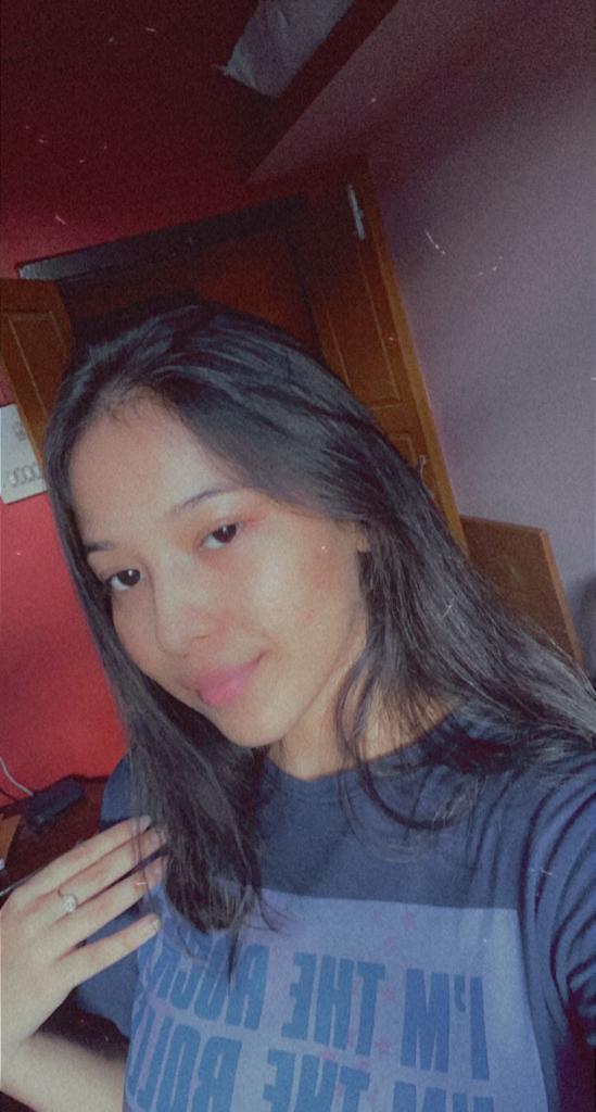 afsana2113's tweet photo. took me a lot of courage to post this, the difference you guys πππ»
#normalizeskintexture https://t.co/guetJFx1HJ