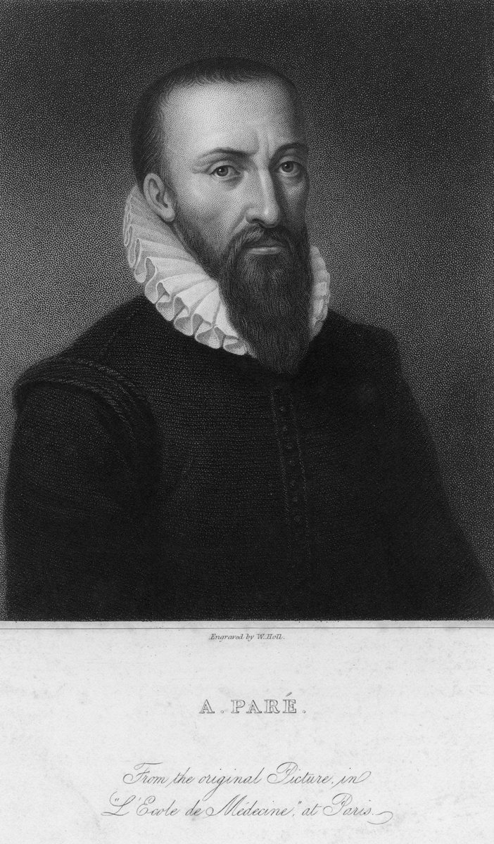 EwenGriffiths's tweet photo. 'when the oesophagus was being sutured great care should be taken' - 1633 Ambrose Pare  5/8 https://t.co/oabsuQSrWX