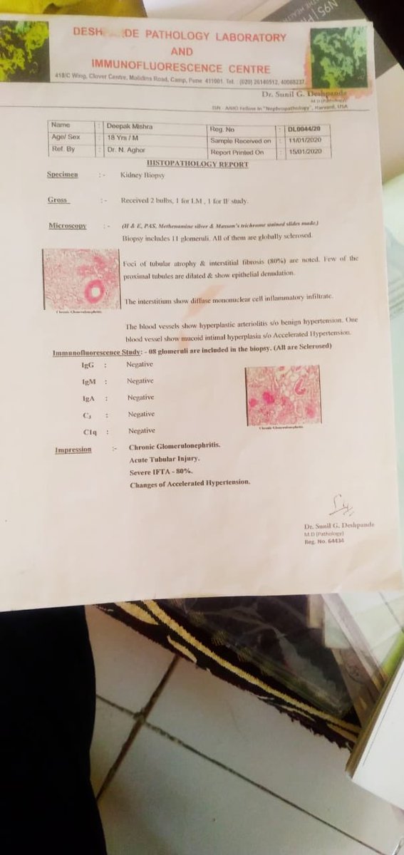 DeepakJ85516653's tweet photo. @SonuSood 
Hi Sir,
I am writing this on behalf of patient Mr. Deepak Mishra (IP No. NSU406Z9) an 18 years male. He is having history of CKD stage V with MHD, HTN.
Now at this stage we only know you as a hero sir.
Hospital: Ashoka medicover Hospitals,Nashik
contact num 997030741 https://t.co/JJiCcTMiUG