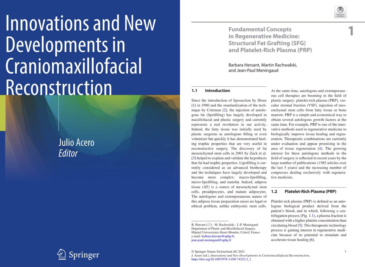 Dr. Martin Rachwalski (@drrachwalski) on Twitter photo New chapter published: „Fundamental Concepts in Regenerative Medicine: Structural Fat Grafting (SFG) and Platelet-Rich Plasma (PRP)“ in the textbook „Innovations and New Developments in Craniomaxillofacial Reconstruction“ <a href="/JPMeningaud/">Jean Paul Meningaud</a> <a href="/eacmfs_org/">eacmfs_org</a> <a href="/GHUMondor/">GHU APHP. Hôpitaux Universitaires Henri-Mondor</a> <a href="/APHP/">Assistance Publique – Hôpitaux de Paris (AP-HP)</a> <a href="/SpringerNature/">Springer Nature</a> New chapter published: „Fundamental Concepts in Regenerative Medicine: Structural Fat Grafting (SFG) and Platelet-Rich Plasma (PRP)“ in the textbook „Innovations and New Developments in Craniomaxillofacial Reconstruction“ <a href="/JPMeningaud/">Jean Paul Meningaud</a> <a href="/eacmfs_org/">eacmfs_org</a> <a href="/GHUMondor/">GHU APHP. Hôpitaux Universitaires Henri-Mondor</a> <a href="/APHP/">Assistance Publique – Hôpitaux de Paris (AP-HP)</a> <a href="/SpringerNature/">Springer Nature</a>