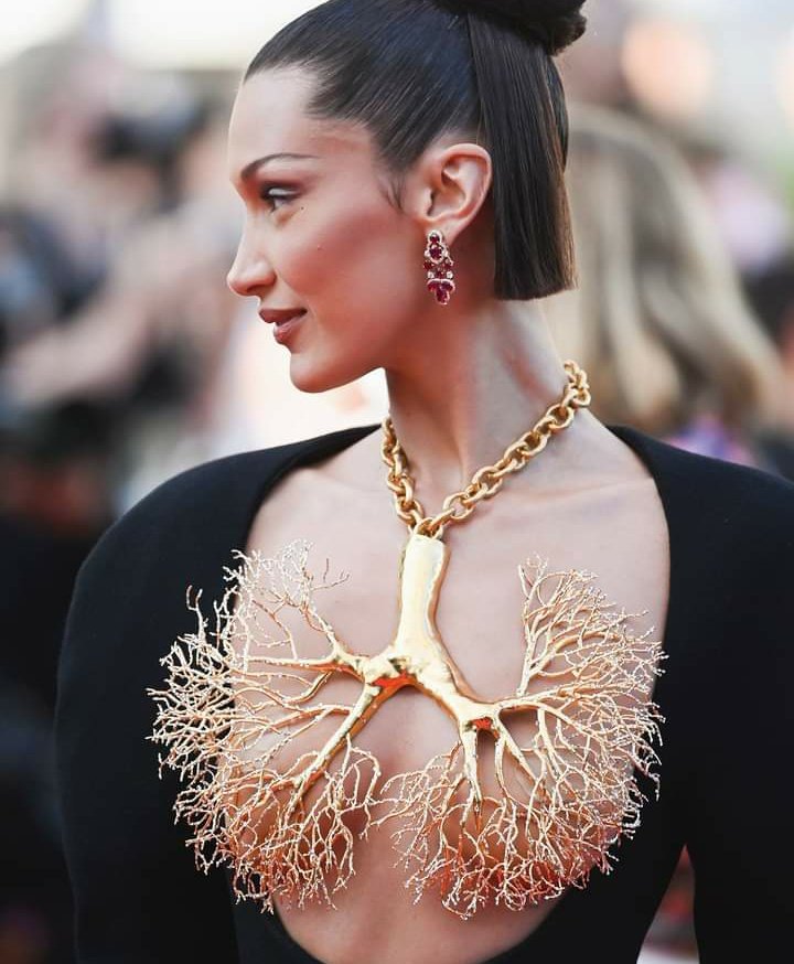 traumacito's tweet image. - No vayas a ir muy mamona a la fiesta.
- La Neumóloga...