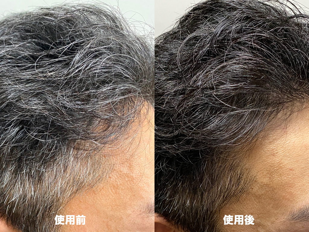 白髪染めシャンプー