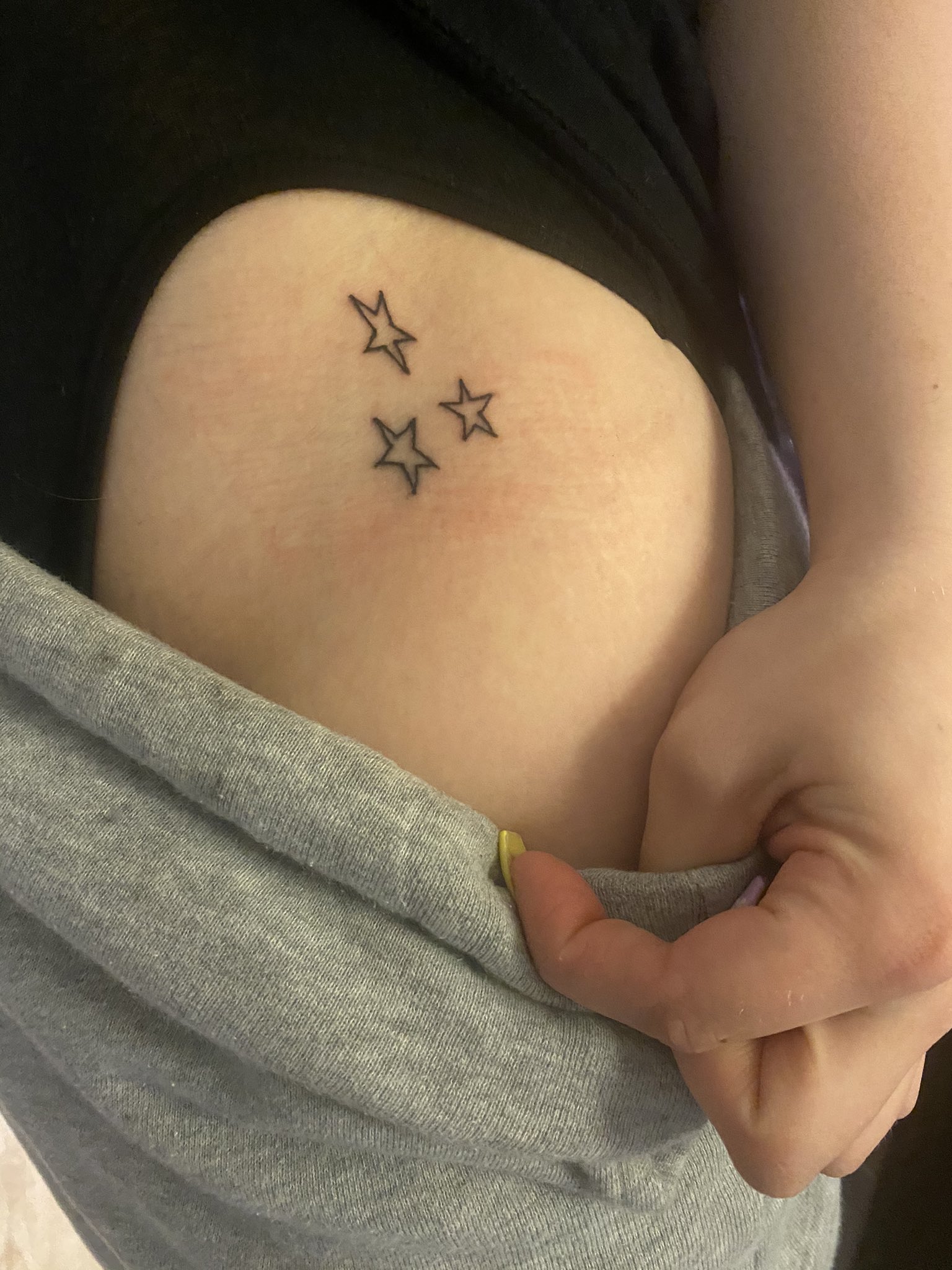 You Drew Stars Around My Scars you drew stars around my scars on X: "@swiftovia okay i didn't get words but the stars symbolize drawing stars around my scars bc i used to self harm on my left