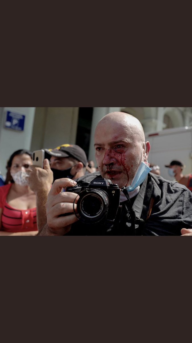 AP photographer Ramón Espinosa wounded covering Havana protests today. Whatever your view on the news, the civilized condemn when journalists are hurt documenting it.