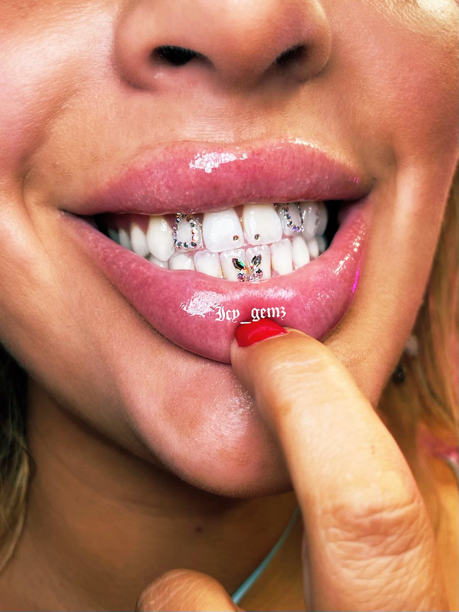 jeanemariee's tweet photo. #toothgems #TooHotToHandle #teethgem https://t.co/PdUf6iBmdd