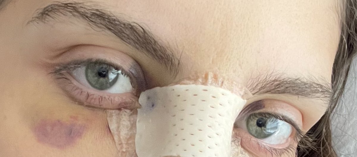 holasunshinee's tweet photo. Y ahora están así 
🤯🤯🤯🤯🤯🤯🤯🤯🤯🤯🤯🤯 https://t.co/NZ19FUQH3a