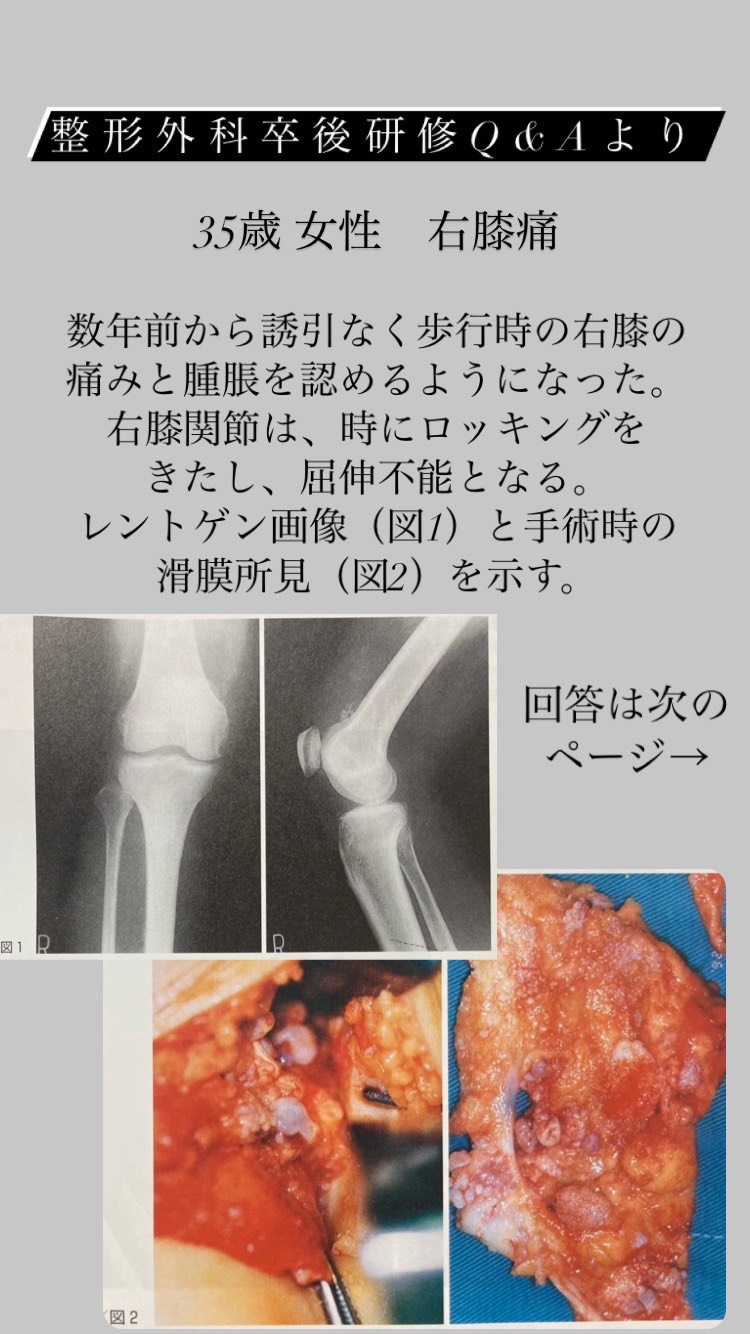 セラピストのための鑑別診断 - その他