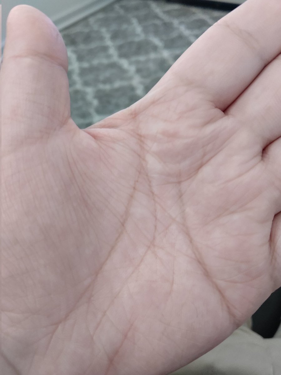 The_McStick's tweet image. So I have seen that the &quot;M&quot; shape is important in palm reading, but what does it mean if I got two? my right hand is dominant, but I was ambidextrous as a toddler. #palmreading #palmology #palmstudy