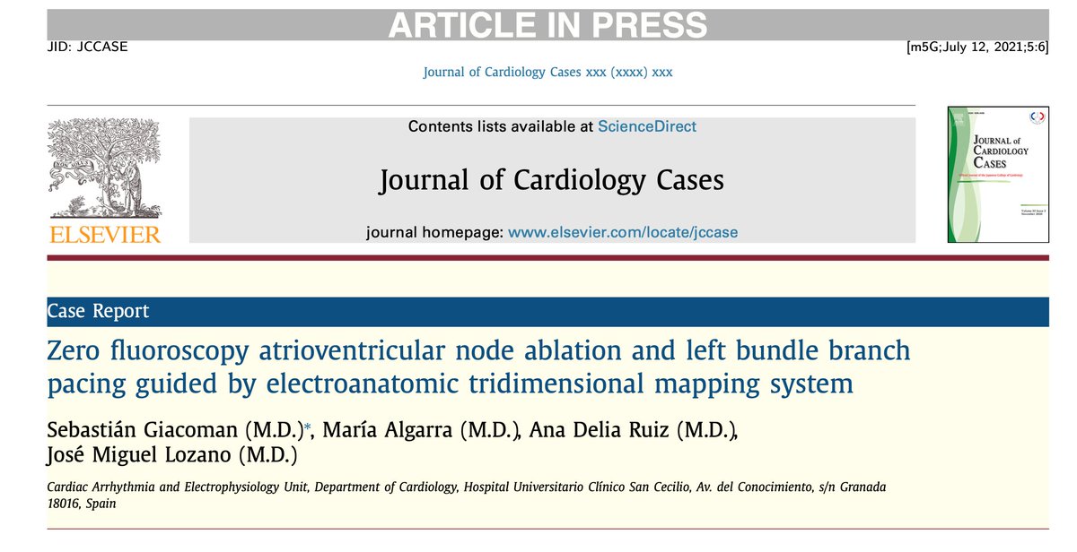 Zero fluoroscopy atrioventricular node ablation and left bundle branch pacing guided by electroanatomic tridimensional mapping system.
#dontdisthehis #Epeeps