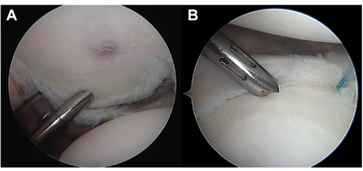 AOSSM Journals tweet media