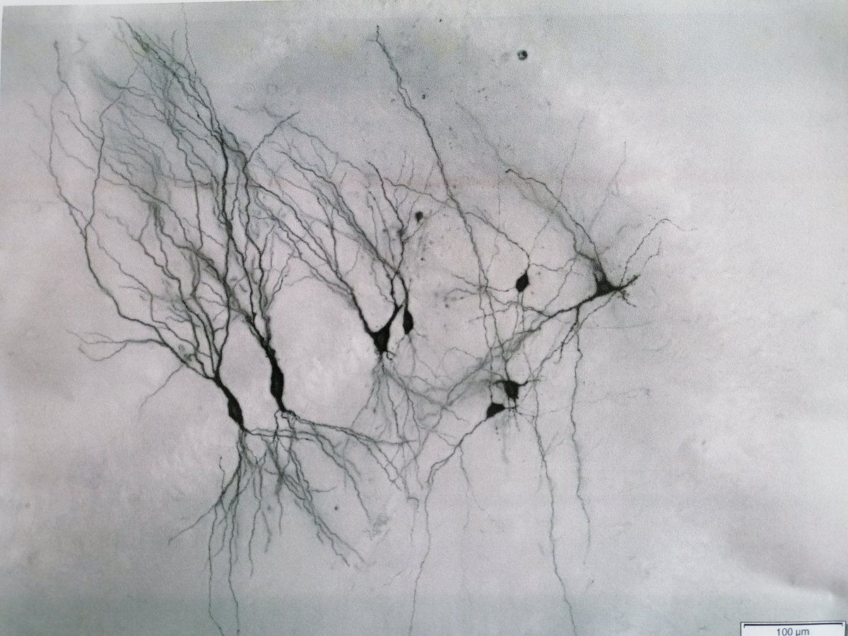 Beautiful stain of simultaneously recorded neurons in the hippocampus #neuroscience #patchclamp