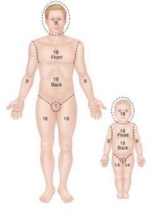 Rn_mf1's tweet photo. الحروق ، نسبه الحرق و درجاته و معادله باركلاند لحساب كميه السوائل

#التمريض  #nursing_intern  #طب https://t.co/NsVm0nPIgn